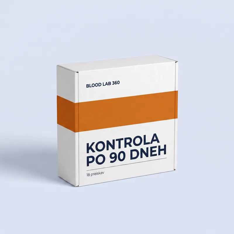 Kontrolni panel po 90 dneh