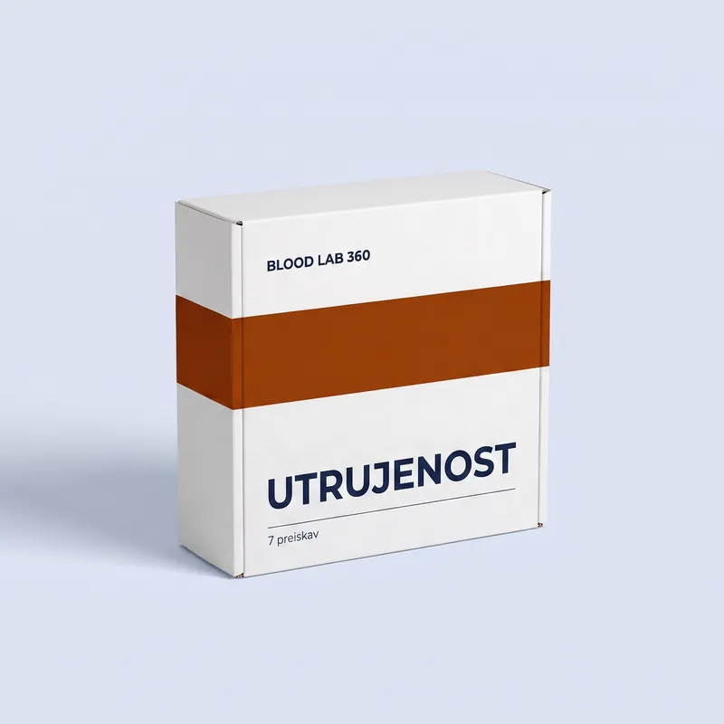 UTRUJENOST